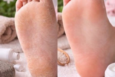 Гладкие пятки Сгенерировано ИИ